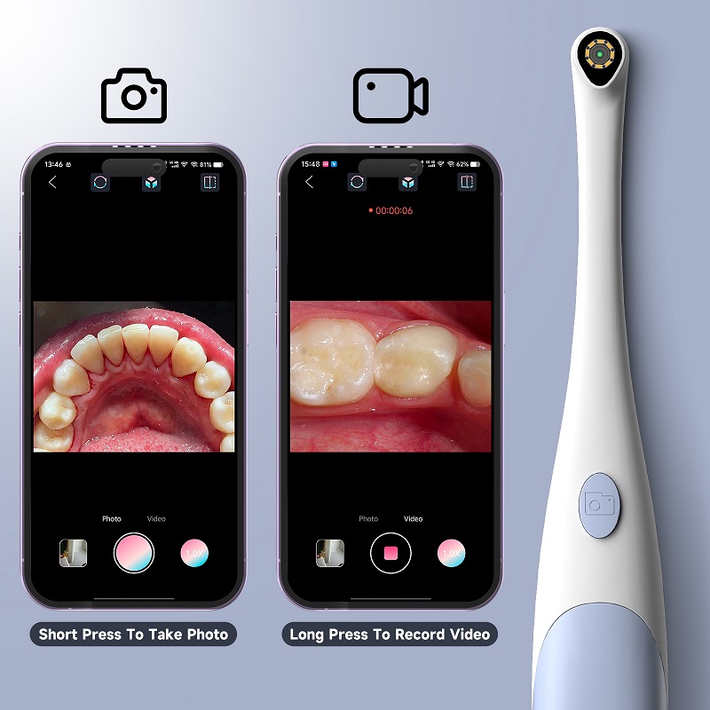 Caméra endoscopique orale 1440 - Photography Lighting Handheld avis et prix
